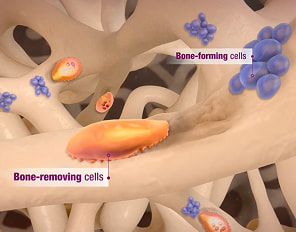 TYMLOS MOA graphic portraying bone-forming cells adding new bone, and bone-removing cells removing old, damaged bone.